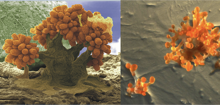 Myxobacteria: Sorangium cellulosum
